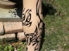 tatt-prosthesis1