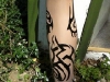 tatt-prosthesis2